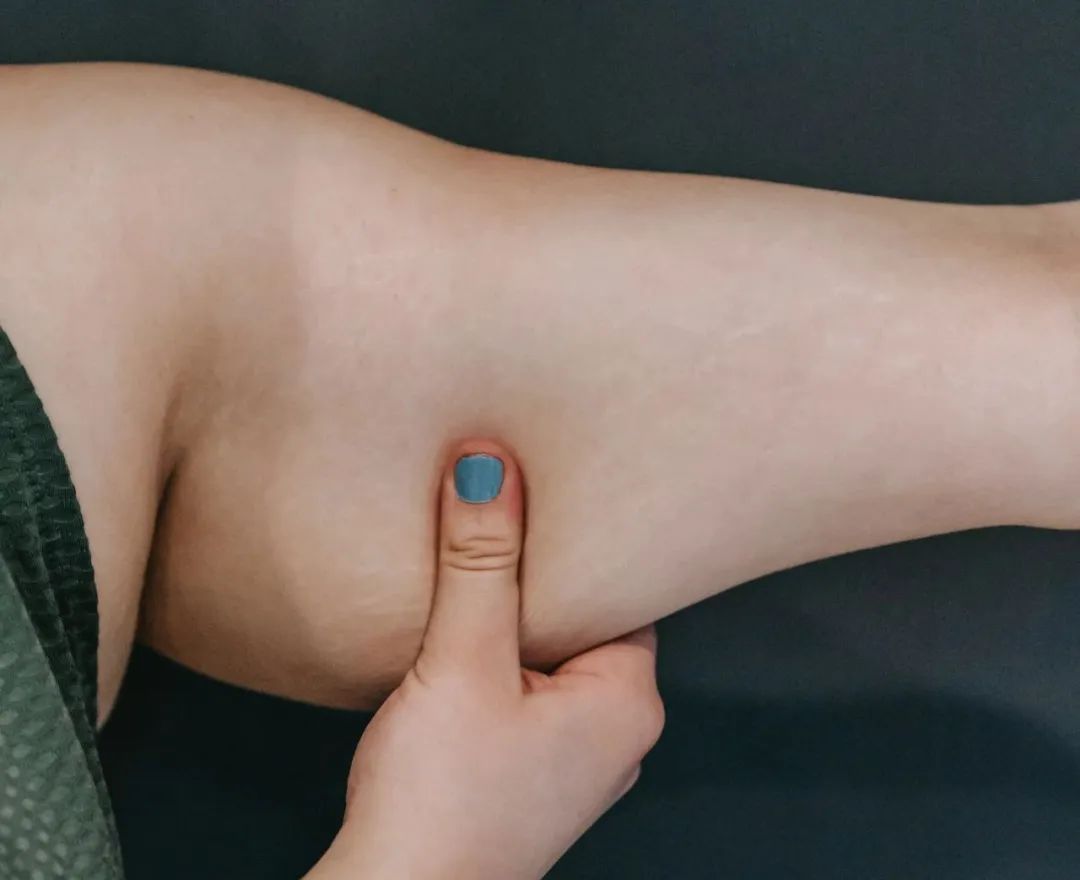 賽樂賽：不同肥胖類型，應(yīng)該怎么減肥